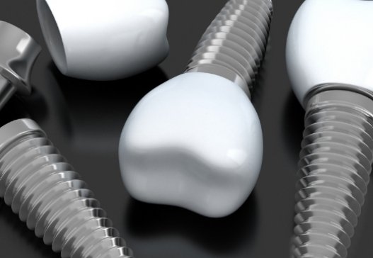 Three animated dental implants