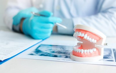 Dentist’s gloved hands at desk with X-rays, model teeth, and paperwork