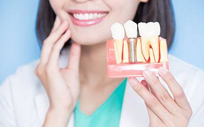 A model of implant parts, things that affect the cost of dental implants in Warsaw