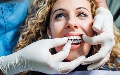 Dentist placing clear aligner on smiling patient