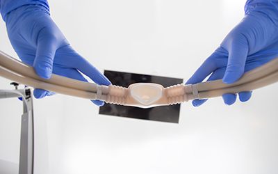 Looking up at dentist’s hands removing nitrous oxide mask