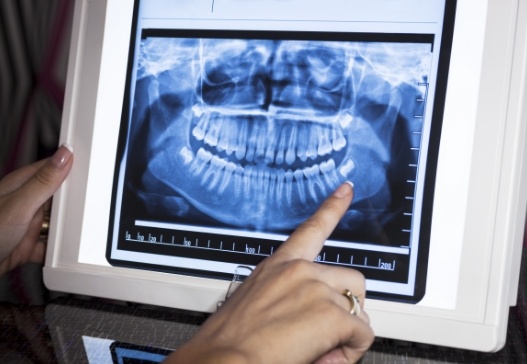 Dental team member reviewing all digital x-rays