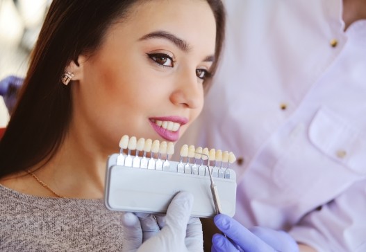 Woman's smile compared with teeth whitening shades